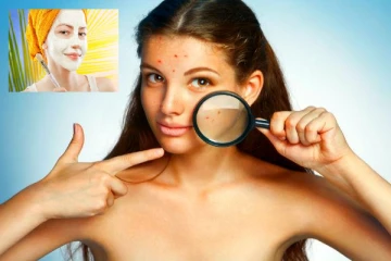 முகத்தில் அதிக தழும்பு உள்ளதா? உங்களுக்கான அழகுக்குறிப்புகள்