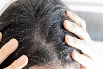 தலைமுடியின் அழகை குறைக்கும் வெள்ளை முடி - இலகுவான முறையில் கருமையாக்குவது எப்படி?