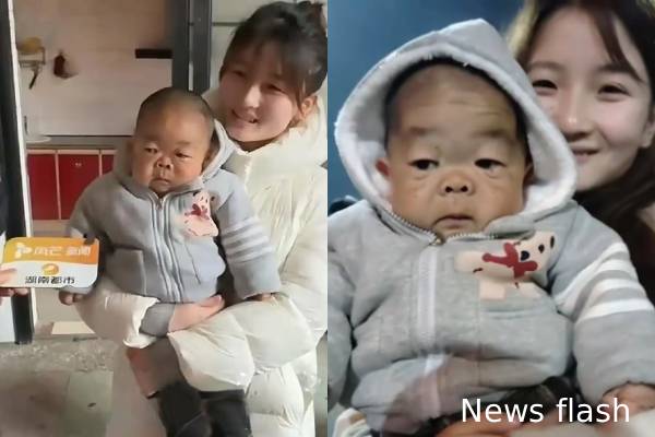 25 வயது அண்ணனை இடுப்பில் சுமக்கும் தங்கை: பின்னணி | Girl Carry Her 25 Yr Old Mini Brother Like Baby