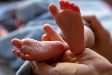 தலையும் வாயும் இல்லாமல் பிறந்த குழந்தை!