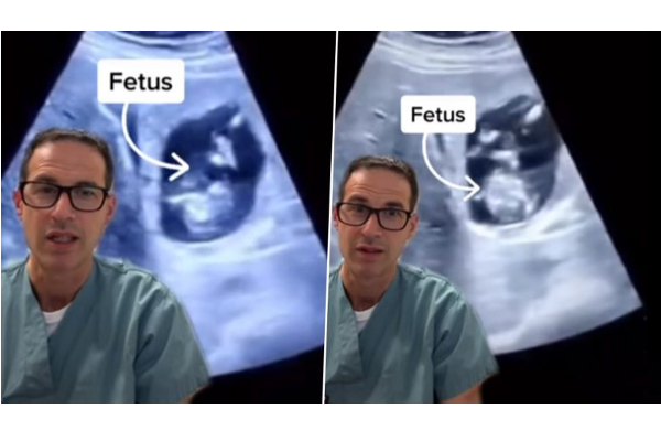 இளம்பெண்ணின் கல்லீரலில் வளர்ந்த கரு!! நம்ப முடியாத உண்மை சம்பவம் | The Baby Growing Inside The Liver