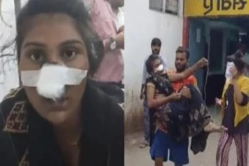 மனைவியின் மூக்கை அறுத்த கணவனால் பரபரப்பு