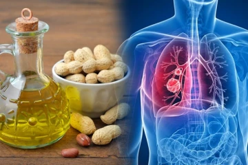 உங்களுக்கு புற்றுநோய் வரக்கூடாதா? அப்போ இந்த உணவுகளை அதிகமாக சாப்பிடுங்க போதும்!