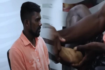 சித்திரவதையினால் மனநலம் பாதிக்கப்பட்ட முன்னாள் போராளி (Video)