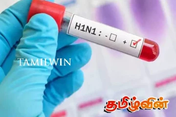 பன்றிக்காய்ச்சல் அபாயம் குறித்து வௌியான விசேட வர்த்தமானி அறிவித்தல்