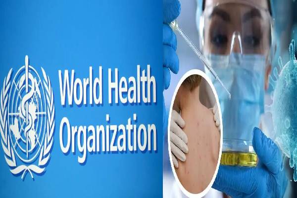 மக்களே எச்சரிக்கையா இருங்க  : குரங்கம்மை சமூகப் பரவலாக மாறும் -  உலக சுகாதார அமைப்பு தகவல் | Who Warns To World Countries For Monkeypox Crisis