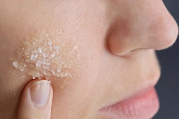 முகப்பரு மற்றும் சரும பிரச்சினைகளுக்கு நிரந்த தீர்வு வேண்டுமா? இந்தவொரு பொருளை இப்படி பயன்படுத்தி பாருங்க