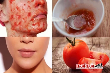 இந்த இரண்டு பொருட்களையும் தக்காளியுடன் கலந்து பூசுங்க - சுருக்கங்கள் மறையும்