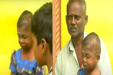 25 வயதாகியும் 2 வயது குழந்தை போல இருக்கும் பெண் - தாயாக மாறிய தந்தை