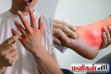 யூரிக் அமில பிரச்சனையால் அவதிப்படுறீங்களா? இந்த ஒரே ஒரு சட்னி போதுமாம்