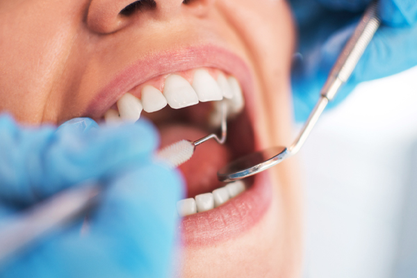 மதிய வேளையில் அதிகமாக சாப்பிட்ட உணர்வா? அப்போ இந்த டீயை அருந்துங்கள் | Feeling Over Eaten At Lunchtime Drink This Tea