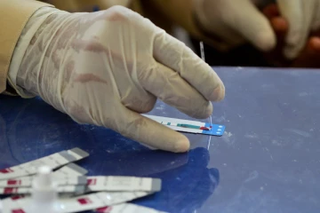 பயன்படுத்திய ஊசியை மீண்டும் பயன்படுத்தியதால் 331 குழந்தைகளுக்கு எச்ஐவி தொற்று