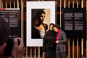 உன்னை எப்படி கட்டியணைக்க முடியும்? போரில் கைகளை இழந்த 9 வயது சிறுவன்