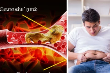 கெட்ட கொழுப்பை வேகமாக வெளியேற்றனுமா? இதில் ஏதாவது ஒன்றை தினமும் குடித்தால் போதுமாம்!