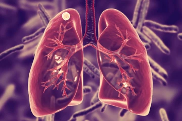 කොළඹ අවට සීඝ්‍රයෙන් ඉහළ යන රෝගයක් ගැන සෞඛ්‍ය අමාත්‍යංශයෙන් අනතුරු ඇඟවීමක්.