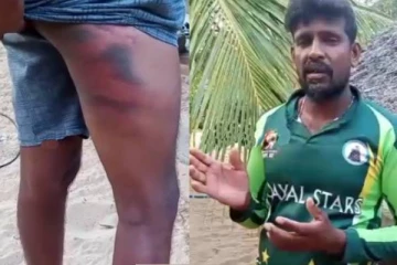 யாழில் மீனவர் ஒருவரை மூர்க்கத்தனமான தாக்கிய மர்ம நபர்கள்!