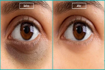 ஒரே இரவில் கருவளையத்தை நீக்கும் குங்குமப்பூ எண்ணெய் - வீட்டிலேயே செய்வது எப்படி?