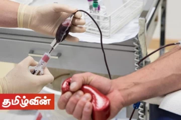 யாழில் அனைத்து வகை இரத்தத்திற்கும் தட்டுப்பாடு! - பொது மக்களிடம் விடுக்கப்பட்டுள்ள கோரிக்கை