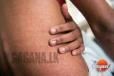 රෝගය ව්යාප්තවෙයි – පැතිරෙන ප්රදේශ හඳුනාගැනීම අපහසුයි
