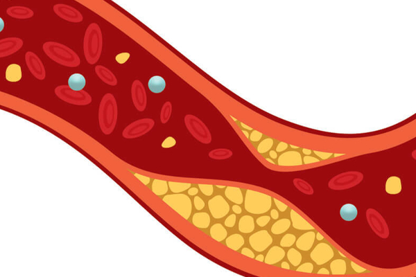 உடலில் கொழுப்பு அதிகரித்துவிட்டால் என்னென்ன பிரச்சனைகள் ஏற்படும் தெரியுமா? ஜாக்கிரதை | What Are The Problems If Body Fat Increases
