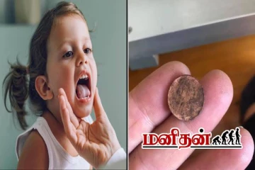 உங்க வீட்டு குழந்தை நாணயத்தை விழுங்கி விட்டதா? இத செஞ்சா போதும்