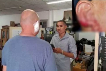 காதை கடித்து விழுங்கிய பெண் பாலியல் தொழிலாளி - இதுதான் காரணமா?