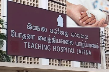 யாழில் காய்ச்சலுக்கு சிகிச்சை பெறச்சென்ற 8வயது சிறுமி : கை அகற்றப்பட்ட துயரம்