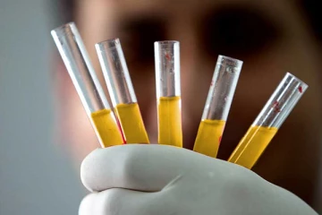 தங்க ரத்தம் பற்றி உங்களுக்கு தெரியுமா? அப்படி என்ன இருக்கு அதில்?