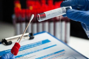 யாழ்.பல்கலைக்கழகத்தில் இருவருக்கு கோவிட் தொற்று