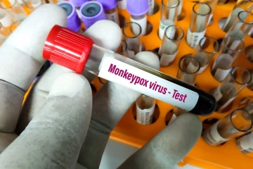 குரங்கு காய்ச்சலை கண்டறியும் கருவிகள் இந்தியாவில் இருந்து இலங்கைக்கு