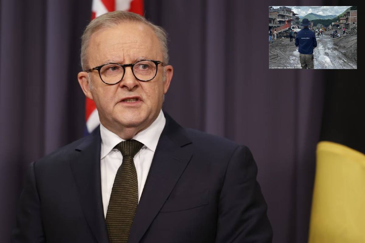 Anthony Albanese