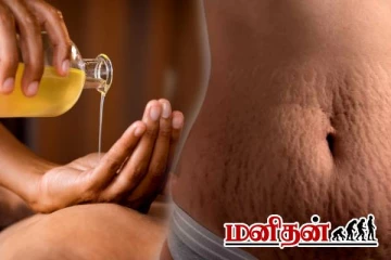வயிற்றில் வரும் கோடுகளை எண்ணெய் மசாஜ் சரிச் செய்யுமா? மருத்துவர் கொடுக்கும் அறிவுரை