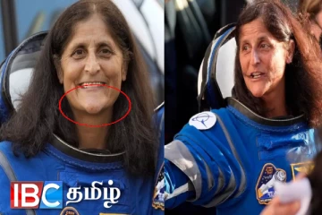 சுனிதா வில்லியம்ஸ் முகத்தில் ஏற்பட்ட மாற்றம்! மருத்துவர்கள் கூறிய விளக்கம்…!