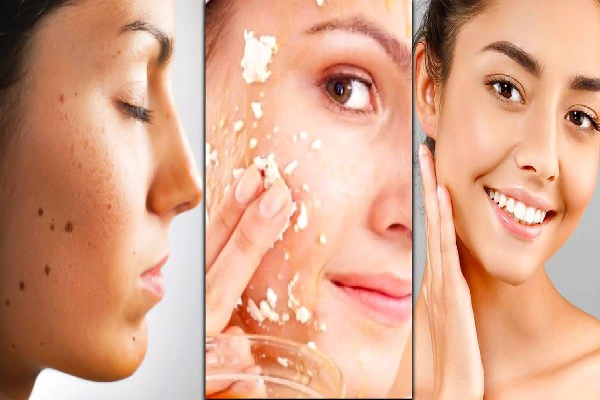 Skincare Tips : முகத்தில் உள்ள கரும்புள்ளிகளை குறைக்க எளிய இயற்கை வழிகள்! | Best Home Remedy For Black Heads From Your Face Skincare Tips : முகத்தில் உள்ள கரும்புள்ளிகளை குறைக்க எளிய இயற்கை வழிகள்! | Best Home Remedy For Black Heads From Your Face