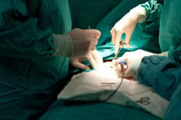 பெண்ணின் வயிற்றில் 2 கத்தரிக்கோல் ; மருத்துவர்களுக்கு காத்திருந்த அதிர்ச்சி!