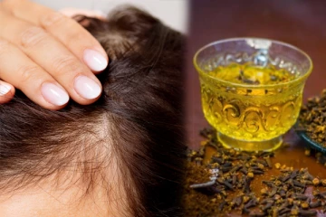 திட்டு திட்டாக கொட்டிய இடத்தில் முடி வளர கிராம்பு தண்ணீர்: கொஞ்ச நாளிலேயே சூப்பரான ரிசல்ட்!