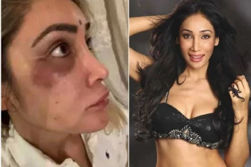 பிரபல நடிகை மருத்துவமனையில் அனுமதி! உயிருக்கு ஆபத்தா? உருக்கமான பேச்சு!