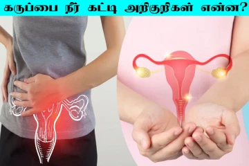பெண்களை தாக்கும் கருப்பை நீர்க்கட்டி... இதன் ஆரம்ப கட்ட அறிகுறிகள் என்ன?