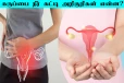 பெண்களை தாக்கும் கருப்பை நீர்க்கட்டி... இதன் ஆரம்ப கட்ட அறிகுறிகள் என்ன?