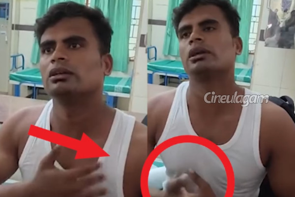 கூமாபட்டி தங்கபாண்டி எலும்பு உடைந்து மருத்துவமனையில் அனுமதி! சிங்கிள் பசங்க ஷோ முடிந்து செல்லும்போது சம்பவம் | Single Pasanga Koomapatti Thangapandi Fracture