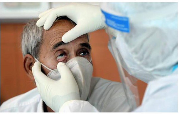 கருப்பு பூஞ்சை நோய் எதனால் ஏற்படுகிறது? அறிகுறியும் தடுக்கும் வழிமுறைகளும்; | Black Fungus Symptoms In Tamil