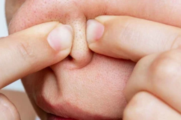 நிமிடங்களில் மூக்கில் உள்ள கரும்புள்ளியை மறைக்கும் வீட்டு வைத்தியம் - எப்படி தெரியுமா?