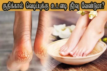 குதிக்கால் வெடிப்புக்கு உடனடி தீர்வு வேண்டுமா? அப்போ இந்த வீட்டு வைத்தியம் போதும்
