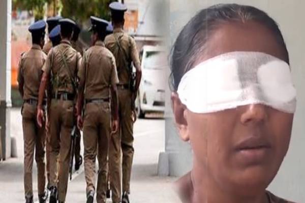 பெண்ணின் கண்களில் பவுடர் தெளித்து கொள்ளை ; மோச செயலால் பார்வையை இழந்த பெண் | The Woman Suffered Great Grief Due Robber Evil Act பெண்ணின் கண்களில் பவுடர் தெளித்து கொள்ளை ; மோச செயலால் பார்வையை இழந்த பெண் | The Woman Suffered Great Grief Due Robber Evil Act