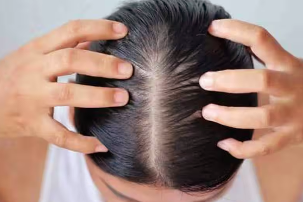 தலைமுடி வேகமான வளர்ச்சி வேண்டுமா? இந்த உணவுகளை கட்டாயம் சாப்பிடுங்க | Faster Hair Crowth Natural Biotin Rich Supplements தலைமுடி வேகமான வளர்ச்சி வேண்டுமா? இந்த உணவுகளை கட்டாயம் சாப்பிடுங்க | Faster Hair Crowth Natural Biotin Rich Supplements