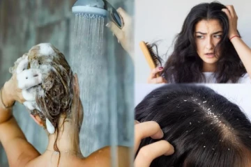 நீண்ட நாட்களாக தலைக்கு குளிக்காமல் இருந்தால் உண்டாகும் பாதிப்புகள் என்னென்ன?