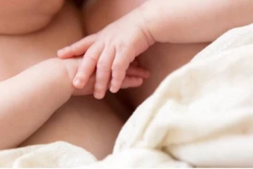 அரிதினும் அரிது! 4 கைகள் மற்றும் 3 கால்களுடன் ஒட்டிப்பிறந்த சிலந்தி இரட்டையர்கள்