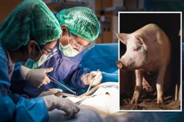 பன்றியின் கிட்னியை மனிதனுக்கு பொறுத்தி சக்ஸஸ்.... மருத்துவ உலகில் புதிய சாதனை!