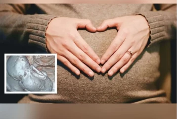 35 ஆண்டுகளாக வயிற்றில் குழந்தையுடன் இருந்த 73 வயது மூதாட்டி - அதிர்ச்சி தகவல்