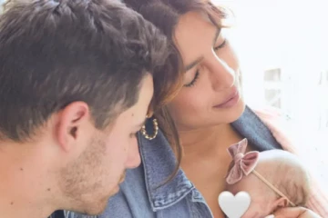 முகத்தில் காயங்கள் பிரியங்கா சோப்ரா வெளியிட்ட புகைப்படம் : அதிர்ச்சியில் ரசிகர்கள்